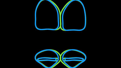 Figura 4. Formas de incisivos centrales reales e ideales.