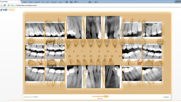 Curve Dental’s new Web-based digital imaging technology poised to change how dentists capture, store and access patient information