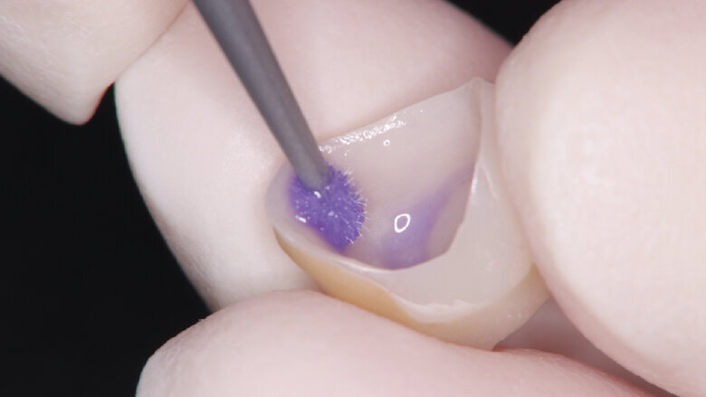 The importance of dental cleaners