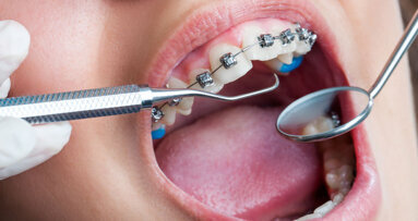 DGKFO befürwortet Forderung nach mehr Forschung in der KFO