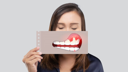 KZBV: Über 30 Millionen Deutsche sind an Parodontitis erkrankt