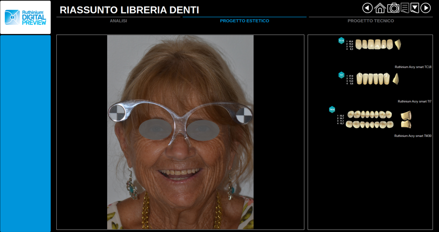 Fig. 2 - La banca dati contenuta nel software Digital Preview consente di scegliere la forma proporzionalmente più idonea alla tipologia del viso del paziente.