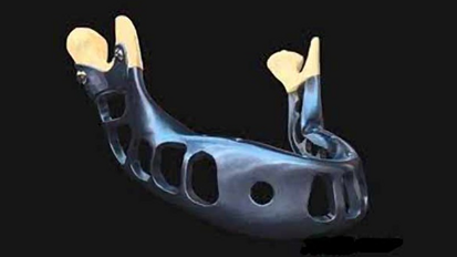 Soluciones en regeneración ósea