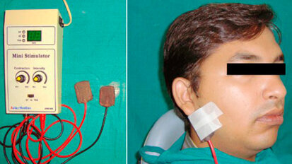 Una terapia a base di elettricità può alleviare la secchezza del cavo orale