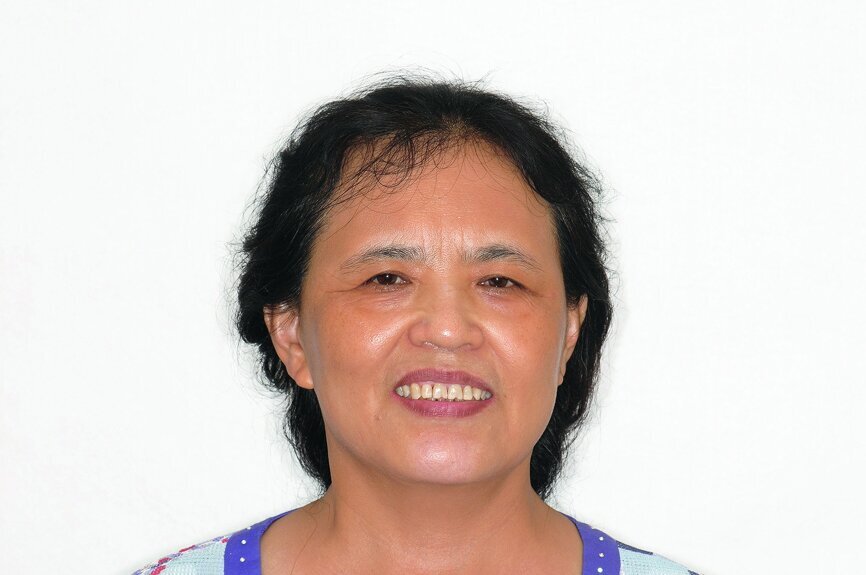 Fig. 5: Frontal view pre-operation.