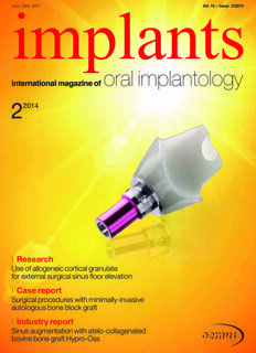 implants international No. 2, 2014 implants international No. 2, 2014