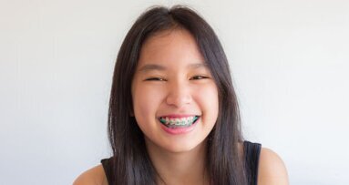 Mercado de suprimentos ortodônticos: Relatório prevê maior taxa de crescimento na região Ásia-Pacífico