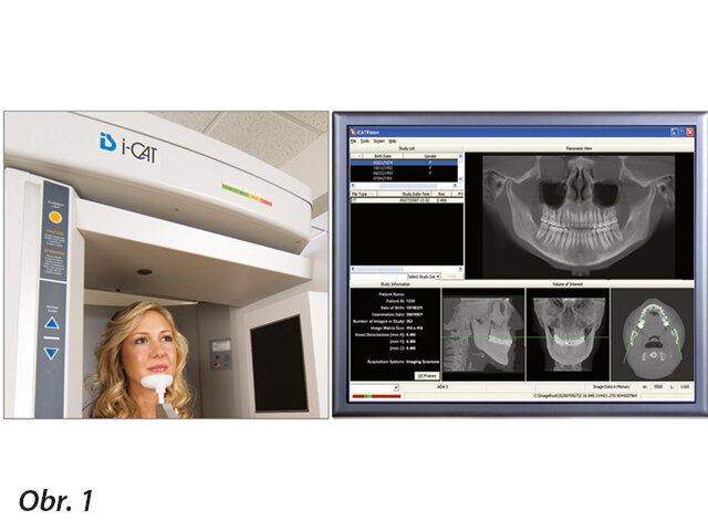 CBCT poskytuje rychlé skenování a okamžitou rekonstrukci (obrázek publikován se svolením i-CAT)