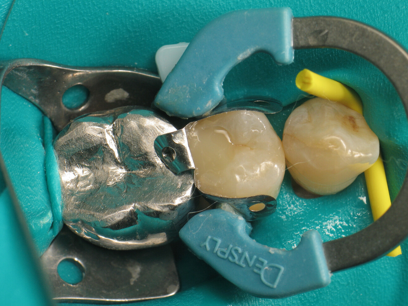 Fig. 12: Application of VisCalor bulk.