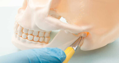 Pesquisadores desenvolvem modelo para localização automática de canais mandibulares