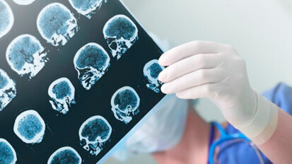 Per mancanza di prove certe ancora poco chiaro il legame tra la salute orale e stato cognitivo