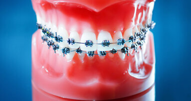 Orthodontisten worden goedkoper