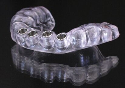 Passage implant-planning software