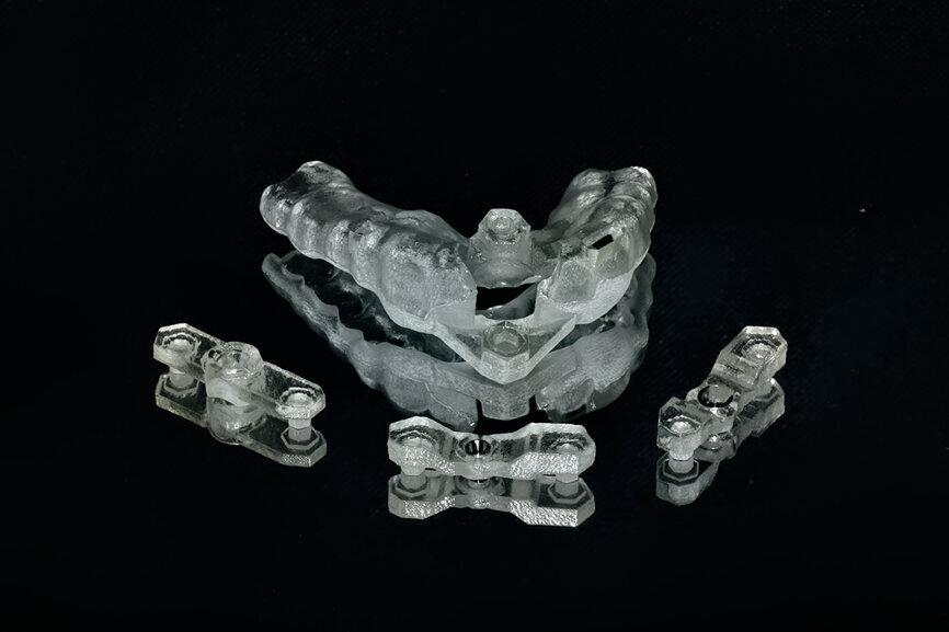 Fig. 11: The stackable tooth-borne guide and the three other separate components.