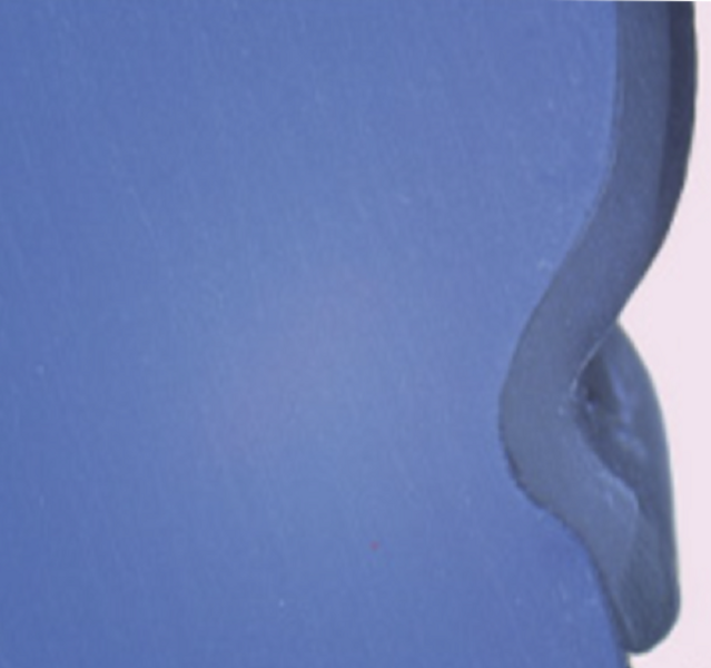 Fig. 13j: The Shape Memory Aligner shows good fit at the cervical third.