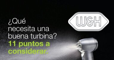 ¿Qué necesita una buena turbina?