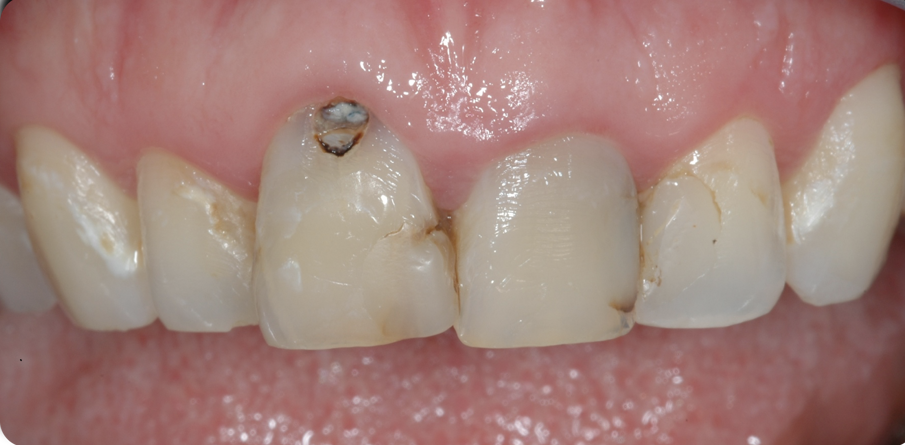 Figg. 1, 2 - Situazione iniziale. 