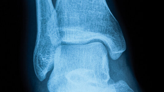 L'avenir offrira des os à la demande et sur mesure