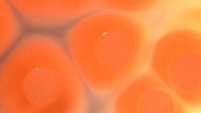   Bakterielle Mikroevolution begünstigt langwierige Krankheitsverläufe