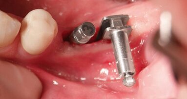 Experte erläutert Technik der Winkelmodulation