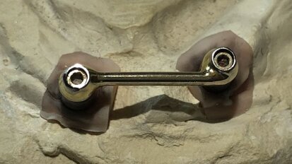 Modificatie van de dolderstaafconstructie