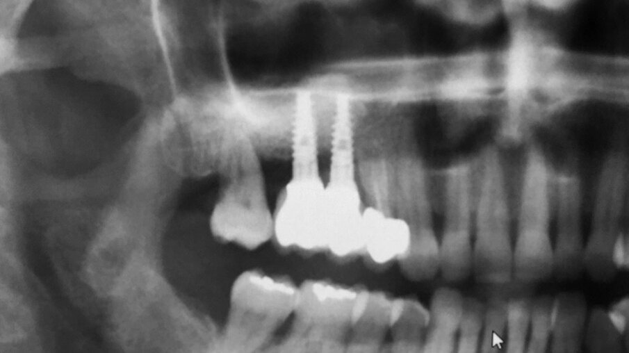 Figg. 16, 17_Opt finale e opt di controllo a 14 mesi dal carico.