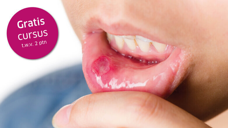 Gratis online cursus ‘Mondafwijkingen’