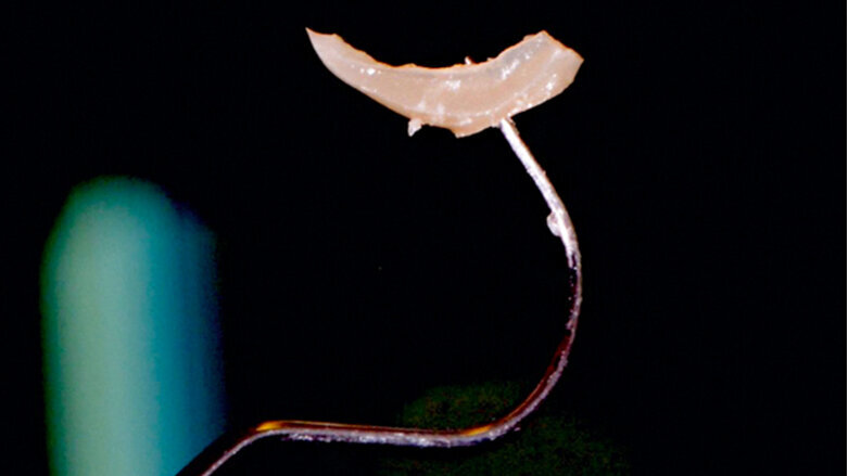 La cementación de materiales cerámicos sin metal