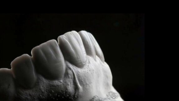 Redefining smile harmony: The concept of Hood Proportion for the  Malaysian population