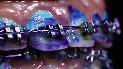 Bacteria are competitive by nature, reveals recent study