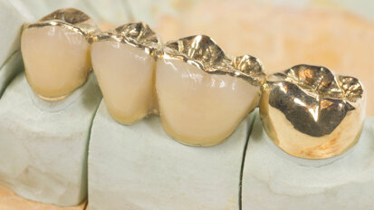 Decline of dental gold production continues