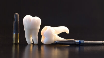 Implantologie soll preiswerter werden