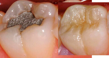 Una ilusión óptica de translucidez