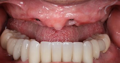 ¿Qué es, cómo funciona y para qué sirve la fotogrametría?