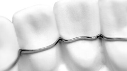 Sirona parceira da CA DIGITAL