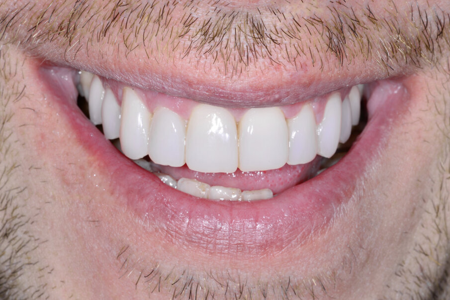 Figs. 23: Detailed view