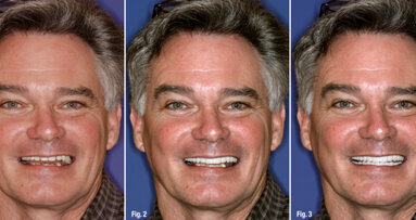 New smile, new life—innovative technologies and techniques can transform a smile