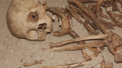 Cálculo dentário indica consumo de plantas na dieta Neandertal