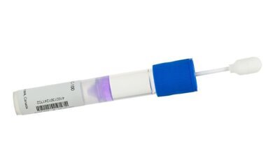 הוצגה בדיקה גנטית חדשה לגילוי סיכון לחלות במחלת חניכיים