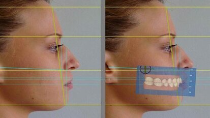Dentofacial aesthetic analysis using 3-D software—Synergy between aesthetic dentistry and aesthetic medicine