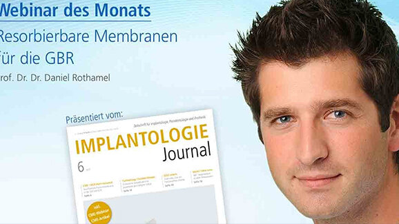 Webinar: Resorbierbare Membranen für die GBR