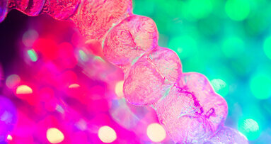 SmileDirectClub to launch SDC+ premium clear aligner treatment