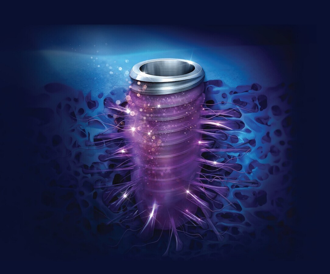 AEEDC 2025: Osstem Implant to showcase next-generation SOI surface technology and digital solutions