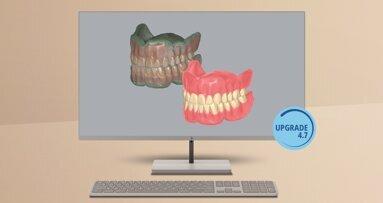 Amann Girbach announces Ceramill update featuring new functions, greater capabilities