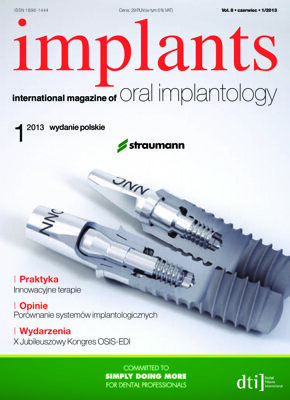 implants Poland No. 1, 2013 implants Poland No. 1, 2013
