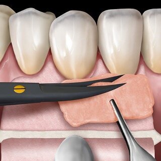 Surgical instrumentation
