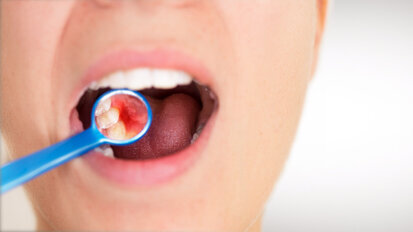 GKV-Finanzstabilisierungsgesetz bedeutet Aus für neue Paro-Therapie