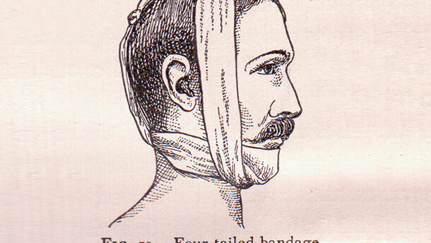 Meer bewijs nodig voor afbreekbare materialen in de kaakchirurgie