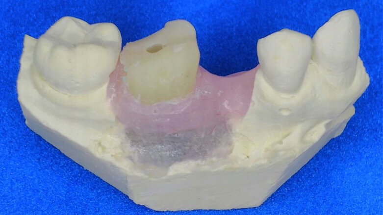 La tecnología y las técnicas tradicionales