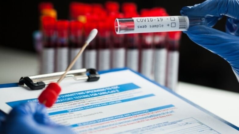 Are new SARS-CoV-2 variants escaping PCR detection?